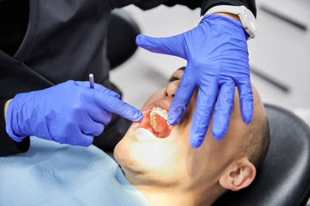 Best Emergency Treatment for Dental Infections or Abscesses in El Campo, TX